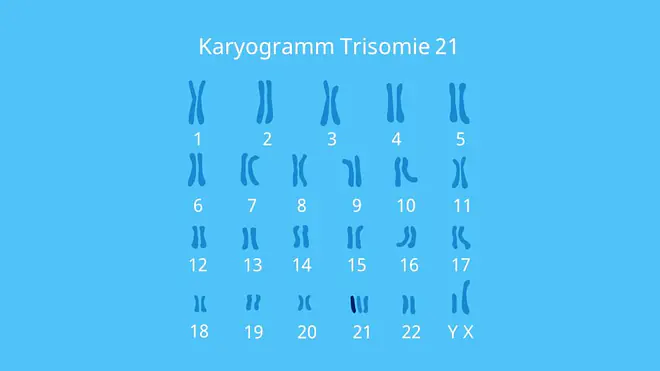 Chromosomen, Mutation, Down Syndrom, Aneuploidie