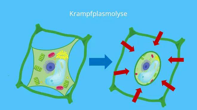 Plasmolyse, Konkavplasmolyse, Protoplast, Pflanzenzelle, konkav, Hechtsche Fäden