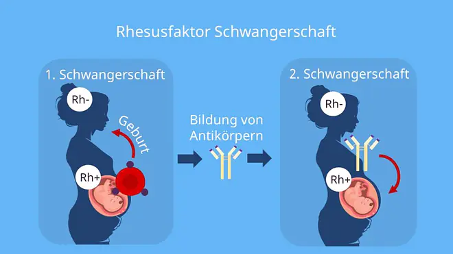  mutter rhesus positiv kind negativ, Rhesusfaktor Schwangerschaft, rhesusfaktor schwangerschaft problem