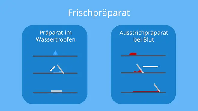 Frischpräparat, Mikroskop, Objekt, Präparat, Vergrößerung