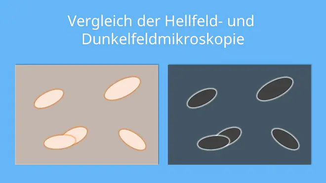Vergleich der Hellfeld- und Dunkelfeldmikroskopie, Mikroskop, Hellfeld, Dunkelfeld, Kontrast, Mikroskopie, Auflichtmikroskop, Durchlichtmikroskop