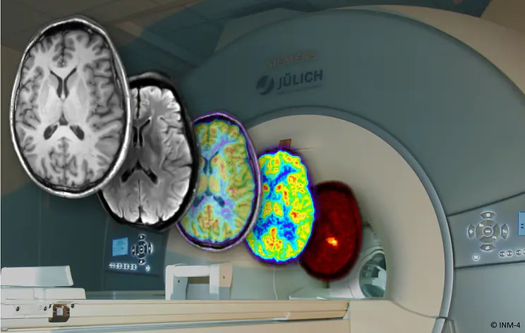 Masterarbeit - Berechnung der Magnetfelder in einem MRT-System auf Grundlage von Permanentmagneten