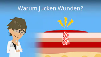 Warum jucken Wunden? 